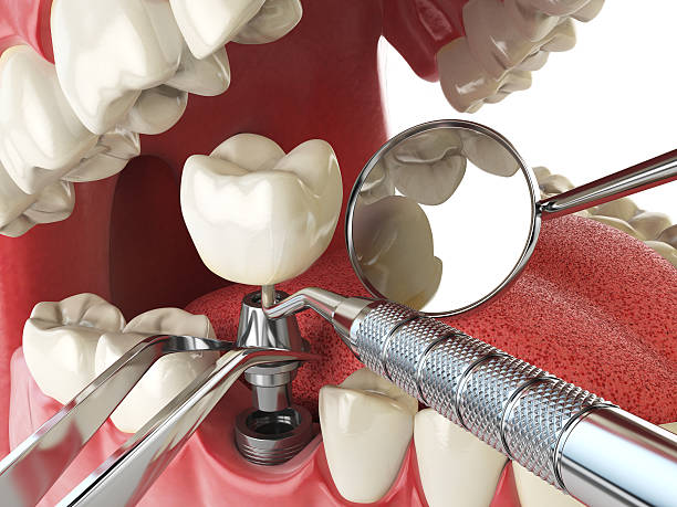 Urgent Tooth Repair in WV